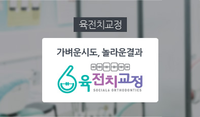 가벼운시도, 놀라운 결과 - 육전치교정