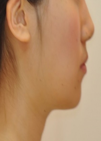 치료후기